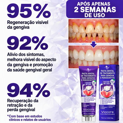 🇵🇹 Loja Oficial |🦷🍖 Rolimey® VioCore Pasta de dentes para o tratamento da inflamação das gengivas e da periodontite com veneno de abelha