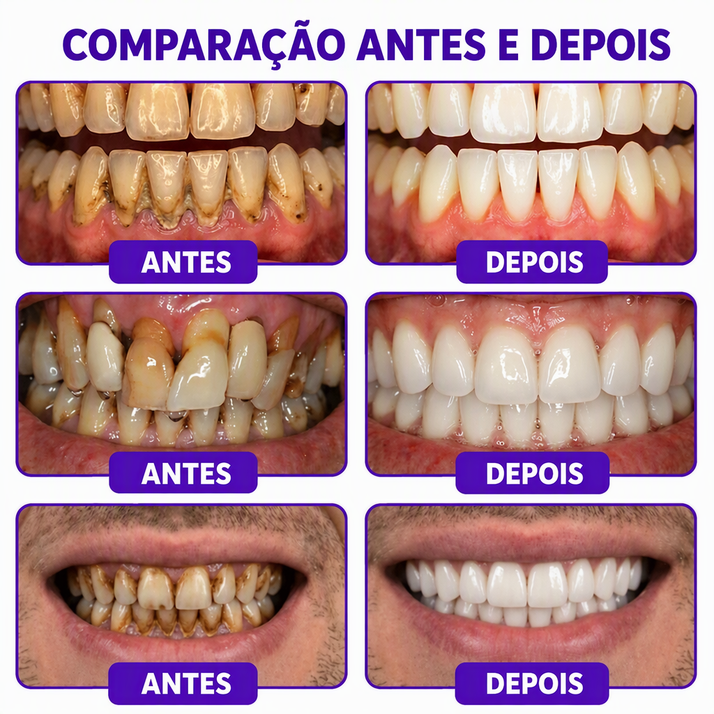🇵🇹 Loja Oficial |🦷🍖 Rolimey® VioCore Pasta de dentes para o tratamento da inflamação das gengivas e da periodontite com veneno de abelha