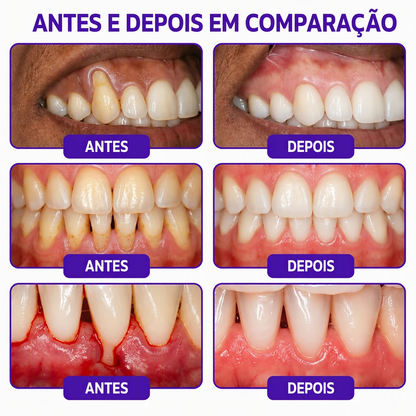 🇵🇹 Loja Oficial |🦷🍖 Rolimey® VioCore Pasta de dentes para o tratamento da inflamação das gengivas e da periodontite com veneno de abelha