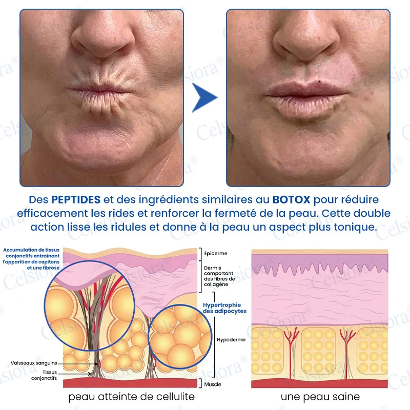 👑𝑳𝒐𝒋𝒂 𝑶𝒇𝒊𝒄𝒊𝒂𝒍 |🎈🎈 Celsiora® Creme Refirmante Antirrugas (Contém Botox e PDRN)