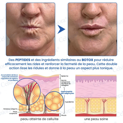 👑𝑳𝒐𝒋𝒂 𝑶𝒇𝒊𝒄𝒊𝒂𝒍 |🎈🎈 Celsiora® Creme Refirmante Antirrugas (Contém Botox e PDRN)