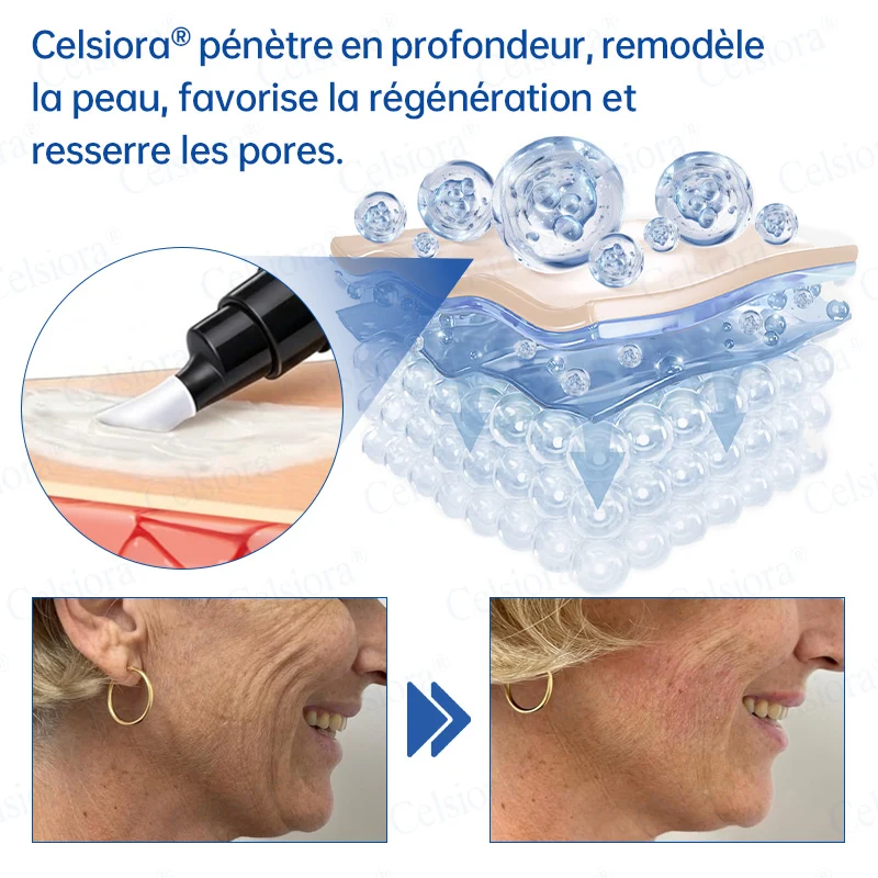 👑𝑳𝒐𝒋𝒂 𝑶𝒇𝒊𝒄𝒊𝒂𝒍 |🎈🎈 Celsiora® Creme Refirmante Antirrugas (Contém Botox e PDRN)