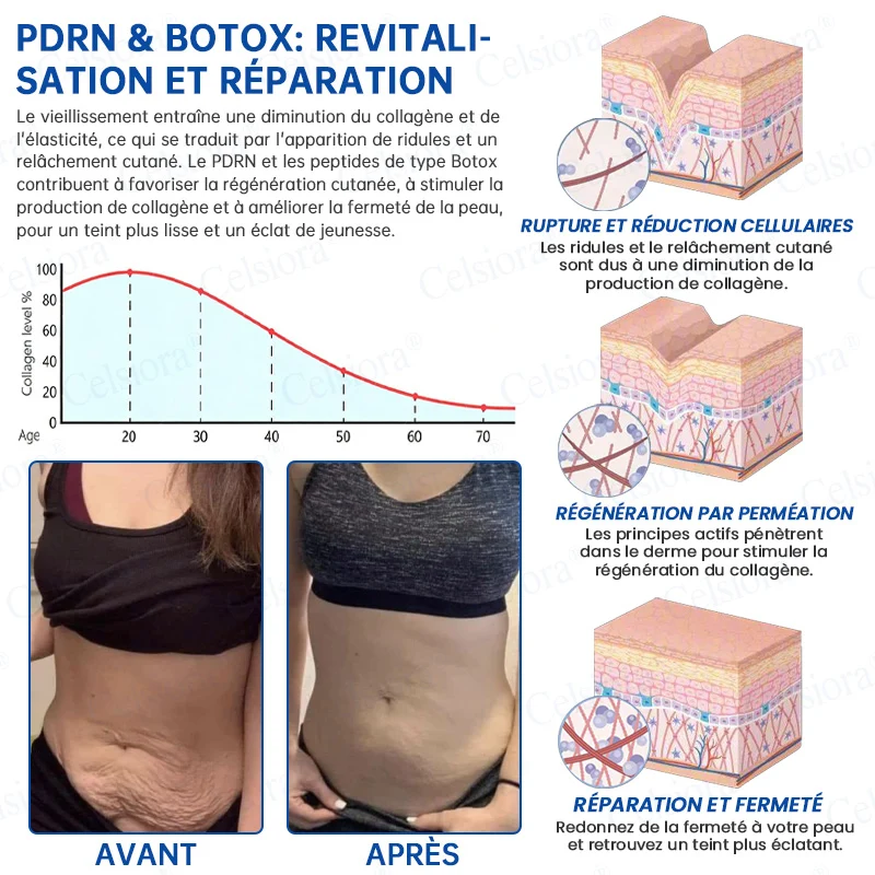 👑𝑳𝒐𝒋𝒂 𝑶𝒇𝒊𝒄𝒊𝒂𝒍 |🎈🎈 Celsiora® Creme Refirmante Antirrugas (Contém Botox e PDRN)