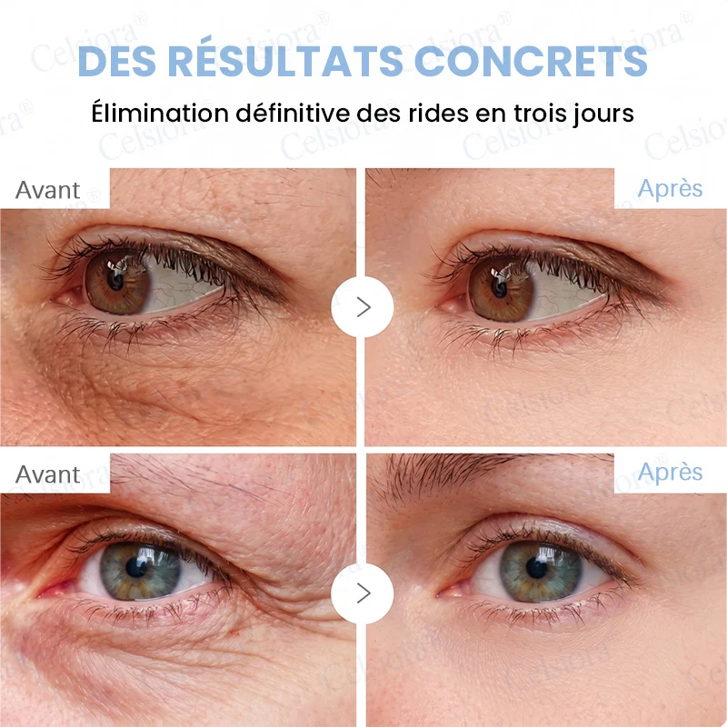 👑𝑳𝒐𝒋𝒂 𝑶𝒇𝒊𝒄𝒊𝒂𝒍 |🎈🎈 Celsiora® Creme Refirmante Antirrugas (Contém Botox e PDRN)