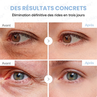 👑𝑳𝒐𝒋𝒂 𝑶𝒇𝒊𝒄𝒊𝒂𝒍 |🎈🎈 Celsiora® Creme Refirmante Antirrugas (Contém Botox e PDRN)
