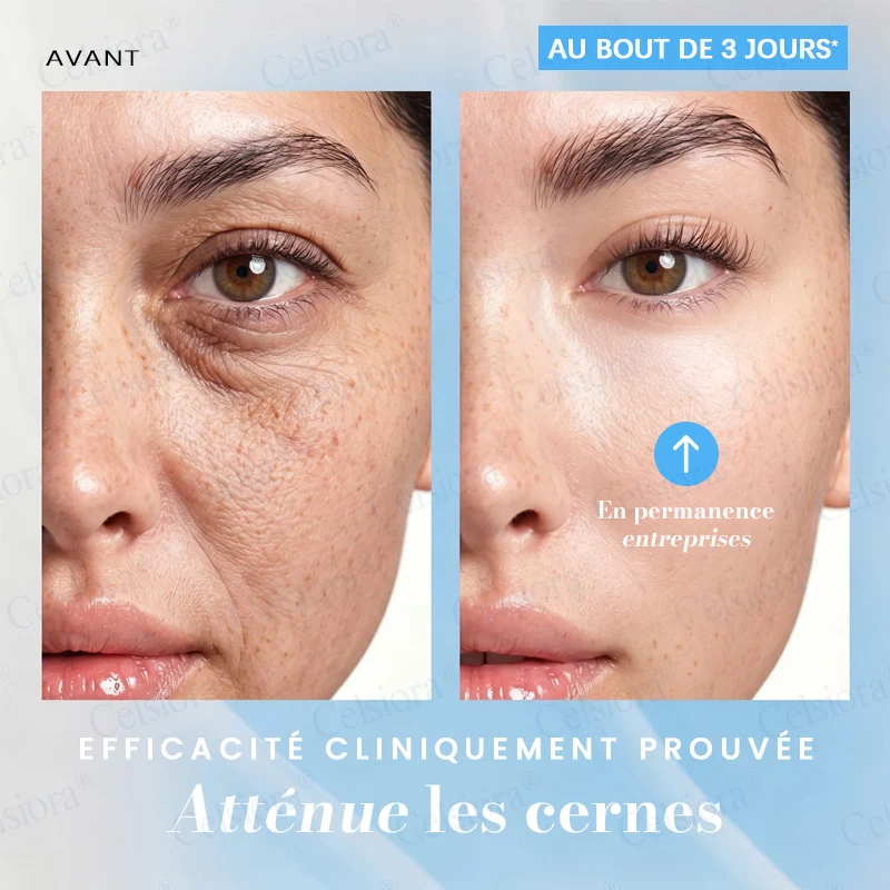 👑𝑳𝒐𝒋𝒂 𝑶𝒇𝒊𝒄𝒊𝒂𝒍 |🎈🎈 Celsiora® Creme Refirmante Antirrugas (Contém Botox e PDRN)
