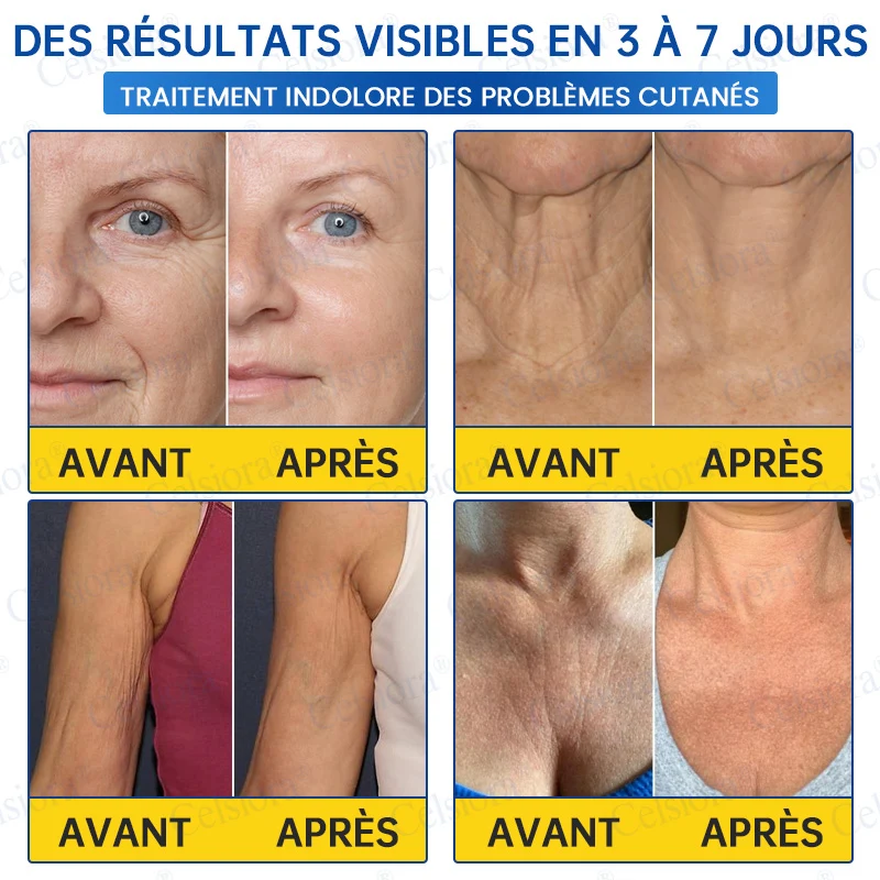 👑𝑳𝒐𝒋𝒂 𝑶𝒇𝒊𝒄𝒊𝒂𝒍 |🎈🎈 Celsiora® Creme Refirmante Antirrugas (Contém Botox e PDRN)