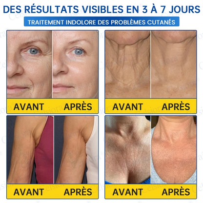 👑𝑳𝒐𝒋𝒂 𝑶𝒇𝒊𝒄𝒊𝒂𝒍 |🎈🎈 Celsiora® Creme Refirmante Antirrugas (Contém Botox e PDRN)