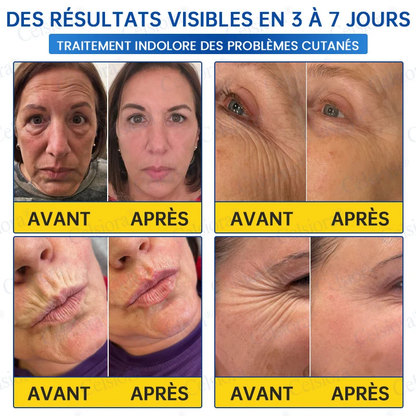 👑𝑳𝒐𝒋𝒂 𝑶𝒇𝒊𝒄𝒊𝒂𝒍 |🎈🎈 Celsiora® Creme Refirmante Antirrugas (Contém Botox e PDRN)