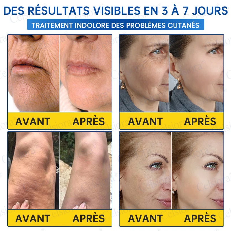 👑𝑳𝒐𝒋𝒂 𝑶𝒇𝒊𝒄𝒊𝒂𝒍 |🎈🎈 Celsiora® Creme Refirmante Antirrugas (Contém Botox e PDRN)