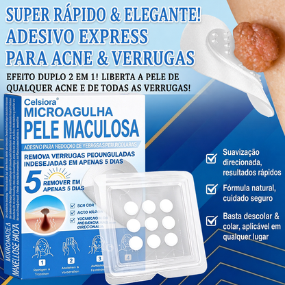 🏆🧨Celsiora® Adesivos 2 em 1 com Microagulhas e Hidrocolóide | Remove Verrugas, Acne, Verrugas Planas e Marcas de Pele | Melhora Rugas, Cicatrizes e Imperfeições | Adesivos Invisíveis em Forma de Estrela para Rosto e Corpo