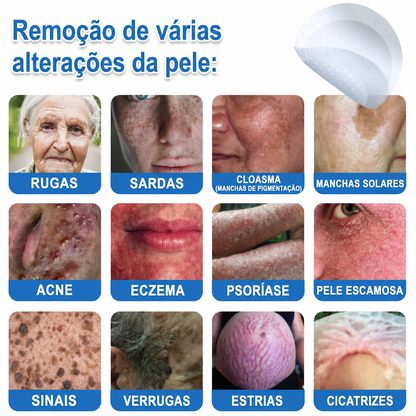 🏆🧨Celsiora® Adesivos 2 em 1 com Microagulhas e Hidrocolóide | Remove Verrugas, Acne, Verrugas Planas e Marcas de Pele | Melhora Rugas, Cicatrizes e Imperfeições | Adesivos Invisíveis em Forma de Estrela para Rosto e Corpo