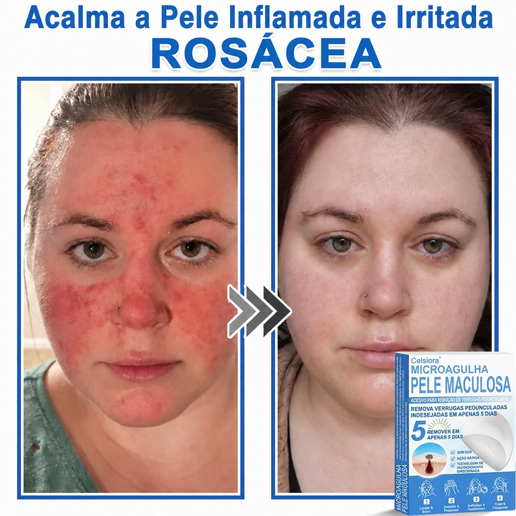 🏆🧨Celsiora® Adesivos 2 em 1 com Microagulhas e Hidrocolóide | Remove Verrugas, Acne, Verrugas Planas e Marcas de Pele | Melhora Rugas, Cicatrizes e Imperfeições | Adesivos Invisíveis em Forma de Estrela para Rosto e Corpo