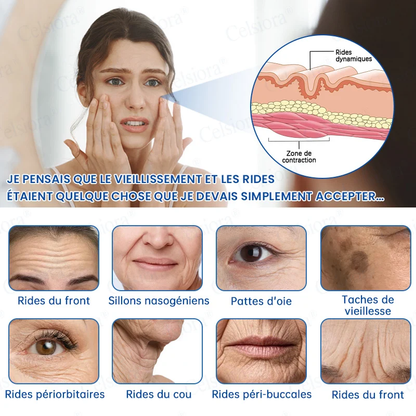👑𝑳𝒐𝒋𝒂 𝑶𝒇𝒊𝒄𝒊𝒂𝒍 |🎈🎈 Celsiora® Creme Refirmante Antirrugas (Contém Botox e PDRN)