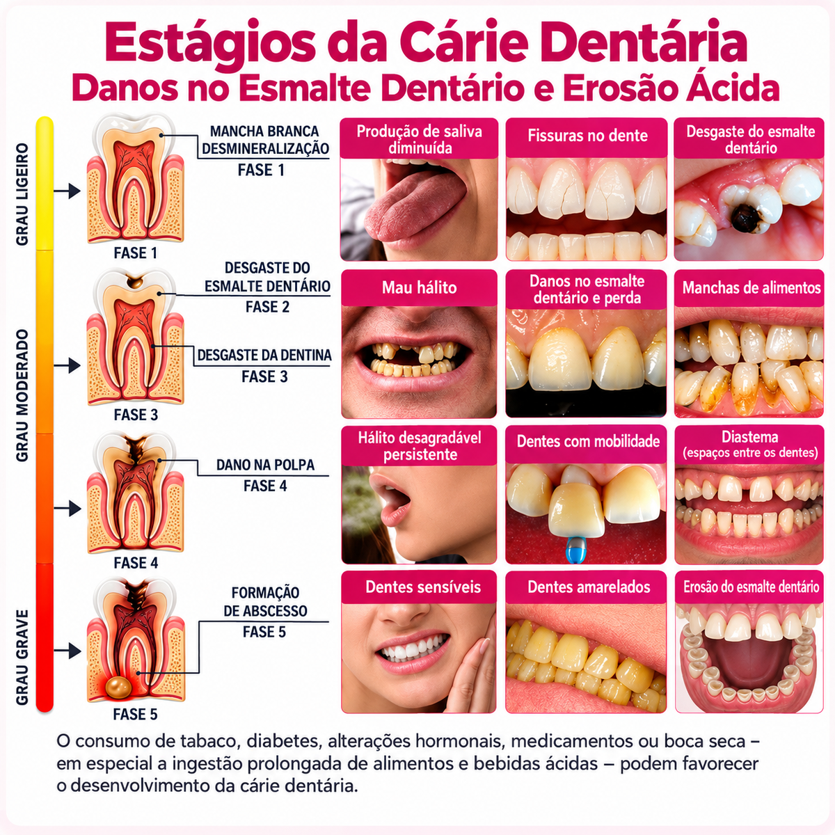 🇵🇹 Loja Oficial |🦷🍗 Rolimey® DenPerm – Gel natural de preenchimento do esmalte dentário para o tratamento de cáries