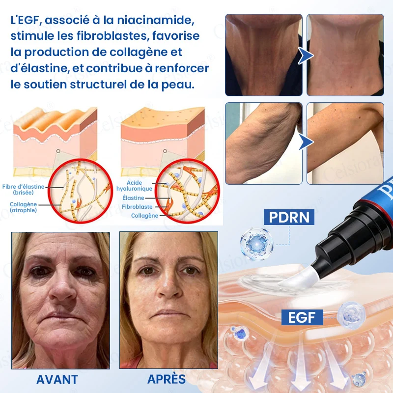 👑𝑳𝒐𝒋𝒂 𝑶𝒇𝒊𝒄𝒊𝒂𝒍 |🎈🎈 Celsiora® Creme Refirmante Antirrugas (Contém Botox e PDRN)