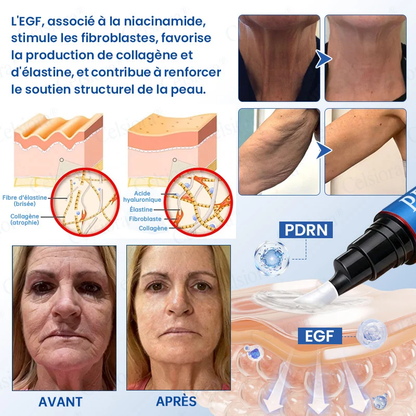 👑𝑳𝒐𝒋𝒂 𝑶𝒇𝒊𝒄𝒊𝒂𝒍 |🎈🎈 Celsiora® Creme Refirmante Antirrugas (Contém Botox e PDRN)